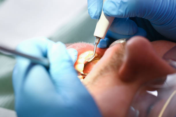 Best Weekend Emergency Dentist in Franklin, PA